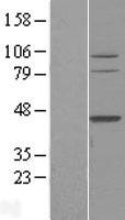 TFB2M Human Over-expression Lysates NM_022366