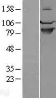 SEMA4A Human Over-expression Lysates NM_022367