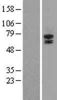 STRA6 Human Over-expression Lysates NM_001142618