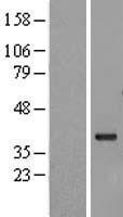 G protein beta subunit like (MLST8) Human Over-expression Lysates NM_022372