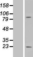 MS4A6A Human Over-expression Lysates NM_152851