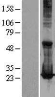 RAB17 Human Over-expression Lysates NM_022449