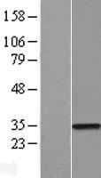 ZNF323 (ZSCAN31) Human Over-expression Lysates NM_030899
