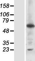 RNF25 Human Over-expression Lysates NM_022453