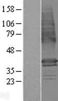 LMBR1 Human Over-expression Lysates NM_022458