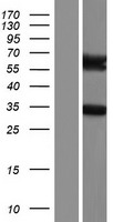 ARHGAP9 Human Over-expression Lysates NM_001080156