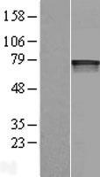 HIF3 alpha (HIF3A) Human Over-expression Lysates NM_152795