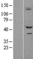 SIL1 Human Over-expression Lysates NM_022464