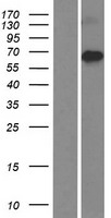 ZNFN1A4 (IKZF4) Human Over-expression Lysates NM_022465