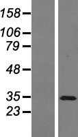 PAG608 (ZMAT3) Human Over-expression Lysates NM_022470