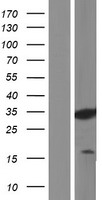 PAG608 (ZMAT3) Human Over-expression Lysates NM_152240