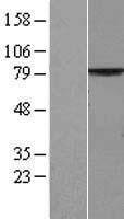 MPP5 Human Over-expression Lysates NM_022474