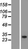 RGS18 Human Over-expression Lysates NM_130782
