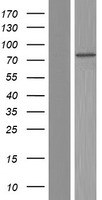 TMEM168 Human Over-expression Lysates NM_022484