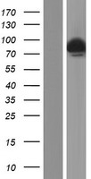 Artemis (DCLRE1C) Human Over-expression Lysates NM_001033855