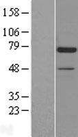 Artemis (DCLRE1C) Human Over-expression Lysates NM_022487