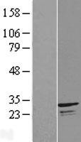 C14orf151 (INF2) Human Over-expression Lysates NM_032714