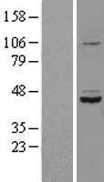 SDS3 (SUDS3) Human Over-expression Lysates NM_022491