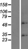ls064429 zdhhc6 human over expression lysates nm 022494 wb testing 1