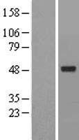 ACTR6 Human Over-expression Lysates NM_022496