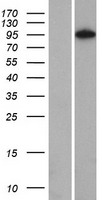 NOM1 Human Over-expression Lysates NM_138400