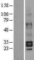 ls064499 tpsb2 human over expression lysates nm 024164 wb testing 1