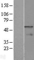 CPEB1 Human Over-expression Lysates NM_001079534