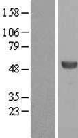 ALDH8A1 Human Over-expression Lysates NM_022568
