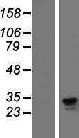 Dectin 1 (CLEC7A) Human Over-expression Lysates NM_197947