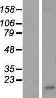 Dectin 1 (CLEC7A) Human Over-expression Lysates NM_197954