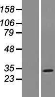 MOSPD3 Human Over-expression Lysates NM_001040098
