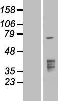 TMPRSS3 Human Over-expression Lysates NM_032405