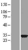 CSN7b (COPS7B) Human Over-expression Lysates NM_022730