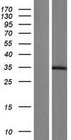 RING finger protein unkempt like (UNKL) Human Over-expression Lysates NM_001037125