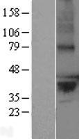 ls064748 lppr2 plppr2 human over expression lysates nm 022737 wb testing 1
