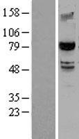 SMURF 2 (SMURF2) Human Over-expression Lysates NM_022739