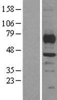 SMYD3 Human Over-expression Lysates NM_022743