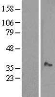 ls064757 mosc1 marc1 human over expression lysates nm 022746 wb testing 1