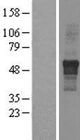 ls064768 ippk human over expression lysates nm 022755 wb testing 1