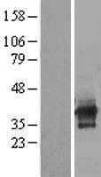 ls064771 ilrun human over expression lysates nm 024294 wb testing 1