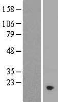 C11orf1 Human Over-expression Lysates NM_022761