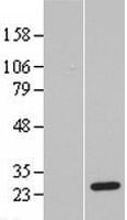 PSF3 (GINS3) Human Over-expression Lysates NM_022770
