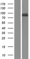 TBC1D15 Human Over-expression Lysates NM_022771