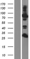 EPS8L2 Human Over-expression Lysates NM_022772