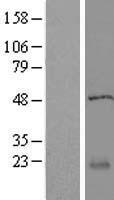 RABL5 (IFT22) Human Over-expression Lysates NM_022777