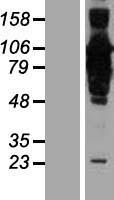 ls064793 ccdc21 cep85 human over expression lysates nm 022778 wb testing 1
