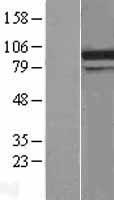 ls064794 ddx31 human over expression lysates nm 022779 wb testing 1