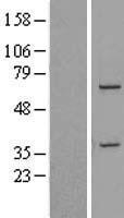 ls064794 ddx31 human over expression lysates nm 138620 wb testing 2