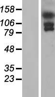 EFCAB6 Human Over-expression Lysates NM_198856