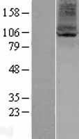 ARV1 Human Over-expression Lysates NM_022786
